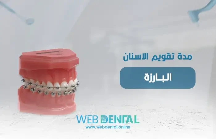 مدة تقويم الاسنان البارزة image