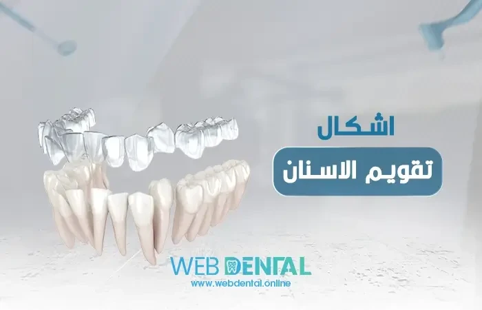 اشكال تقويم الاسنان image