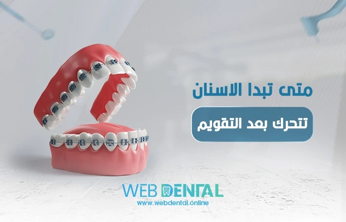 متى تبدا الاسنان تتحرك بعد التقويم؟ image