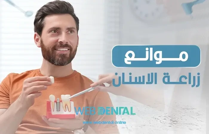 موانع زراعة الاسنان image