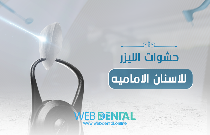 حشوات الليزر للاسنان الاماميه image