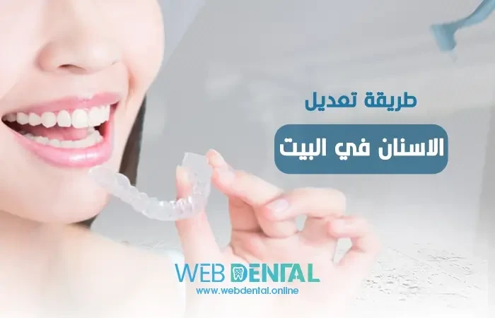طريقة تعديل الاسنان في البيت| هل هي حقيقة أم خرافة؟ image