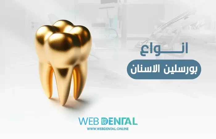 انواع بورسلين الاسنان image