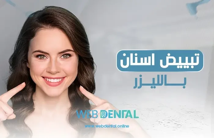 تبييض اسنان بالليزر image