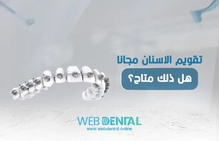 تقويم الاسنان مجانا ـ هل ذلك متاح؟ image
