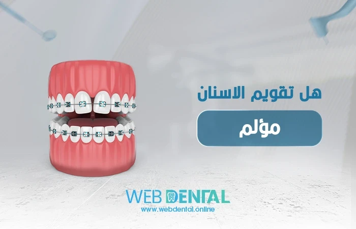 هل تقويم الاسنان مؤلم ؟ image