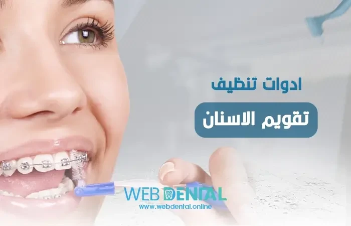 ادوات تنظيف تقويم الاسنان image