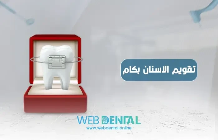 تقويم الاسنان بكام ؟ image