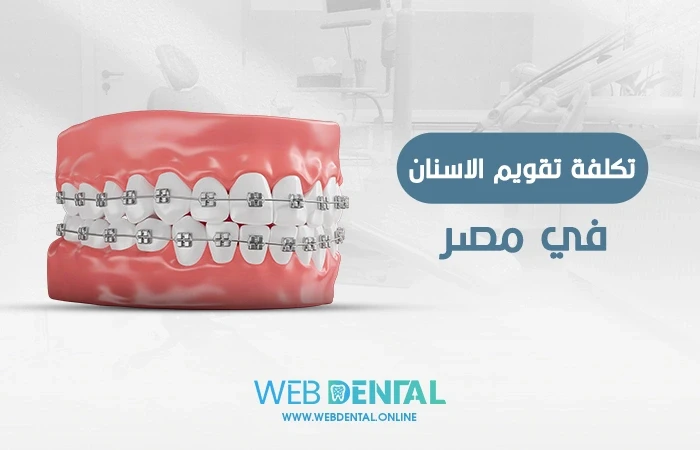 تكلفة تقويم الاسنان في مصر image